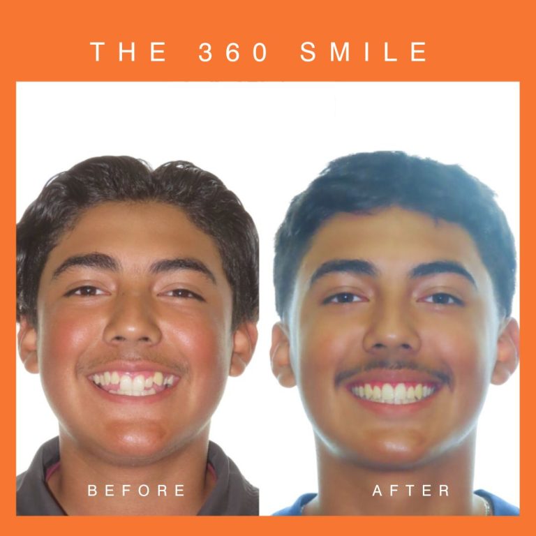 teeth before after c 768x768